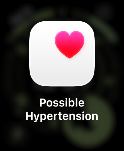 Apple Watch Ultra 3, титанов корпус, натурален цвят, на екрана изскача известие за възможна хипертония, розово сърце в бял прозорец, каишка Trail Loop в син/яркосин цвят